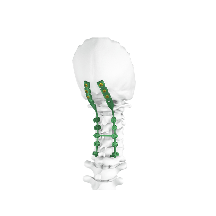 Occipito - Cervico - Sistema della colonna vertebrale toracica (OCT)