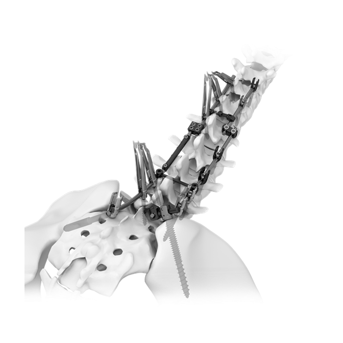 Sistema per la colonna vertebrale TINA