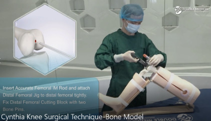 Doppia dimostrazione del modello di sostituzione del ginocchio di Cynthia