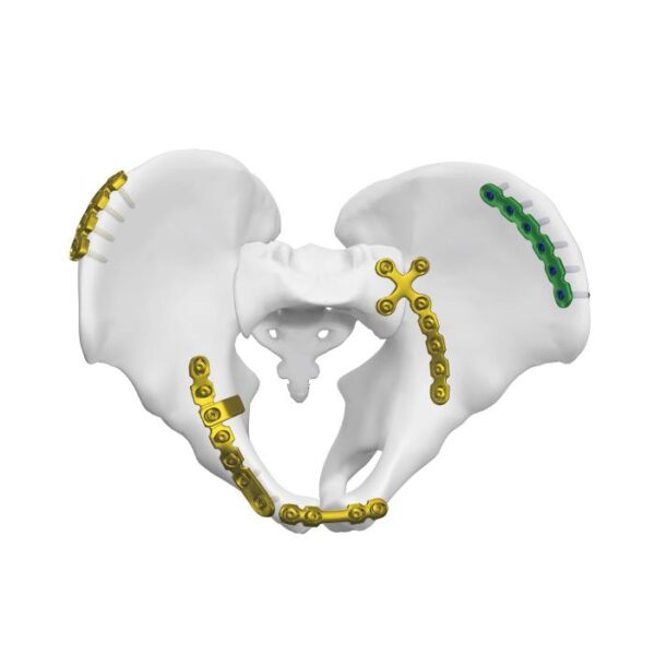Piastra dell'articolazione sacroiliaca anteriore