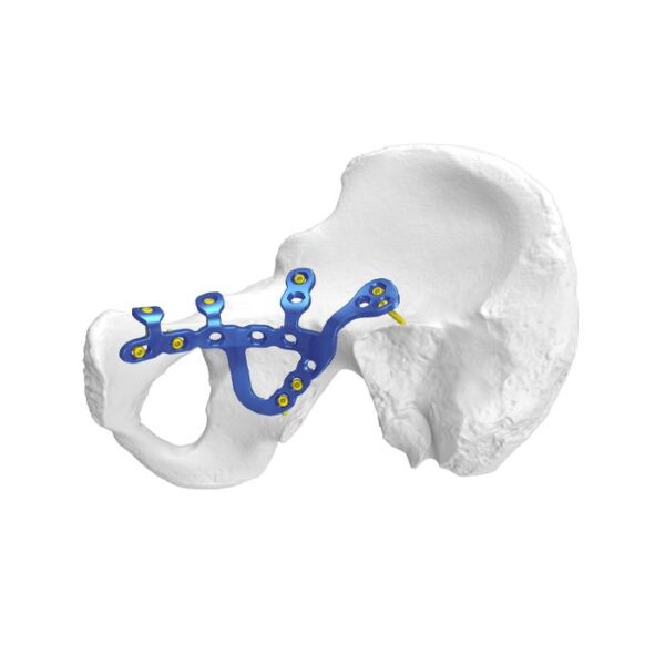 Placca di blocco acetabolare pelvica anatomica