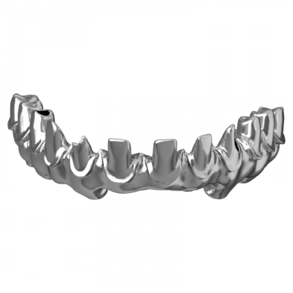 Titanium Implants Bridge